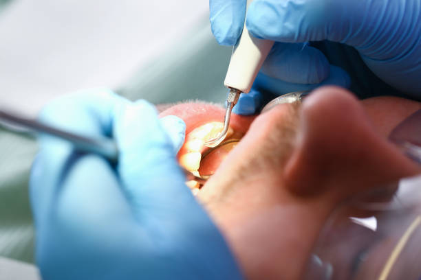Best Emergency Gum Treatment in Thorndale, TX