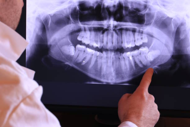 Best Emergency TMJ Treatment in Thorndale, TX