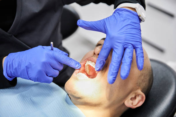 Best Emergency Treatment for Dental Infections or Abscesses in Thorndale, TX