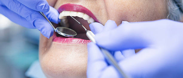 Best Same-Day Emergency Dental Services in Thorndale, TX